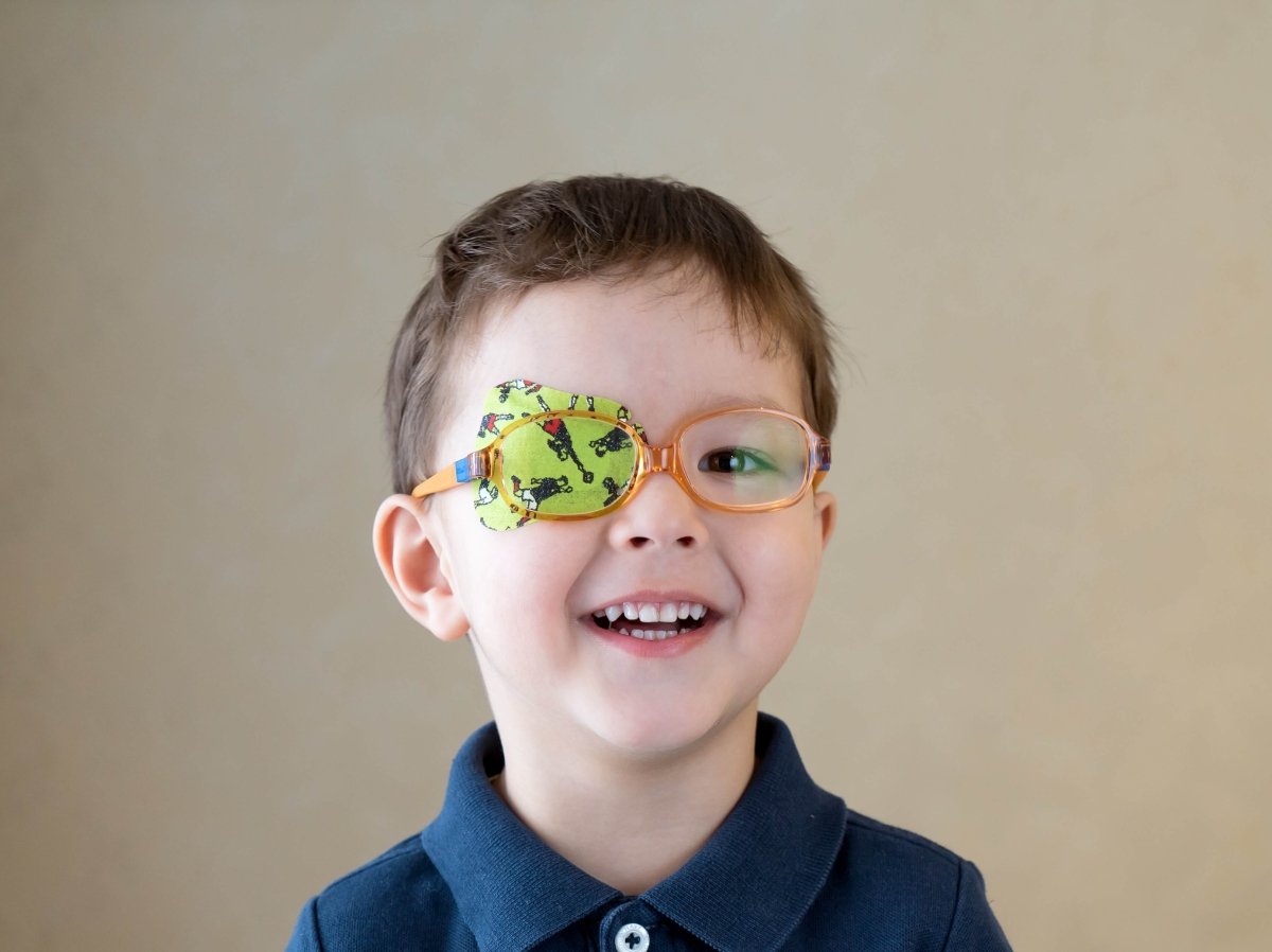 A ambliopia ou “olho preguiçoso” é uma baixa da acuidade visual em um ou ambos os olhos, causada por um estímulo visual inadequado durante o período crítico.